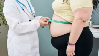 Pauvreté et obésité chez les femmes : quand les inégalités sociales pèsent sur la santé